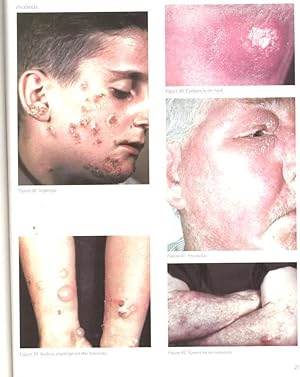Scope Monograph on Dermatology. [Dermatitis; Pigmentation; Dermatophytosis; Pyodermas; Atrophies;...