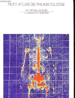 Seller image for PETIT ATLAS DE RHUMATOLOGIE 150 IMAGES DE BASE for sale by Le-Livre