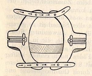 Bild des Verkufers fr Zur Behandlung der Patellafraktur (pp.321-326, 1 Abb.). zum Verkauf von Antiq. F.-D. Shn - Medicusbooks.Com