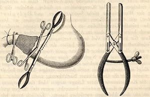 Bild des Verkufers fr Zur Methodik der Magen- und Darmnaht (pp.713-718, 2 Abb.). zum Verkauf von Antiq. F.-D. Shn - Medicusbooks.Com