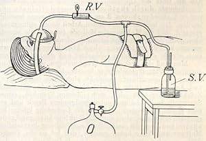 Bild des Verkufers fr Behandlung schwerer Tetanusflle (pp.1953-1956; 1981-1983, 1 Abb.). zum Verkauf von Antiq. F.-D. Shn - Medicusbooks.Com