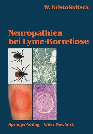 Bild des Verkufers fr Neuropathien bei Lyme-Borreliose zum Verkauf von AHA-BUCH GmbH