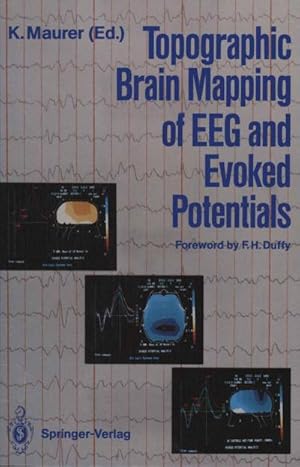 Bild des Verkufers fr Topographic Brain Mapping of EEG and Evoked Potentials zum Verkauf von AHA-BUCH GmbH