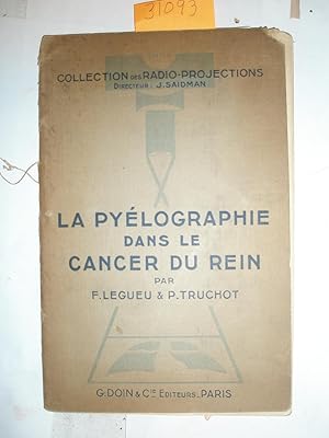 La Pyelographie et le Cancer du Rein