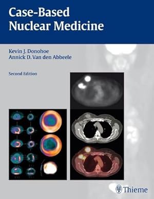 Imagen del vendedor de Case-Based Nuclear Medicine a la venta por BuchWeltWeit Ludwig Meier e.K.
