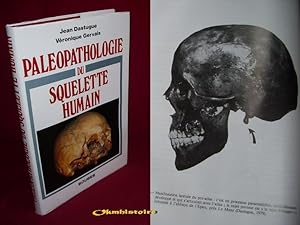Paléopathologie du squelette humain