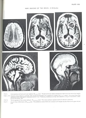 Immagine del venditore per Nuclear Magnetic Resonance and its Clinical Applications. [British Medical Bulletin, (1984) Vol. 40, No.2] [historical review of NMR and its clinical applications -- Basic physics and relaxation mechanisms -- Magnets for medical applications of NMR venduto da Joseph Valles - Books