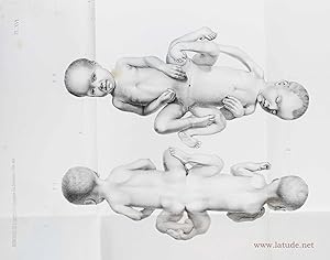Anatomie comparée transcendante. Principes d'embryogènie, de zoogénie et de tératogénie