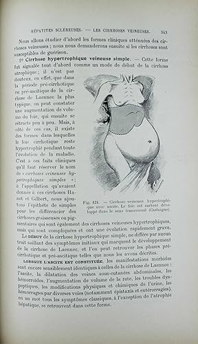 Manuel des maladies du foie et des voies biliaires