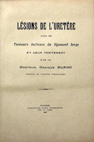 Lésions de l'Uretère dans les tumeurs incluses du ligament large