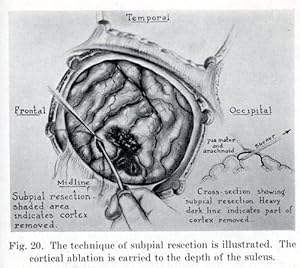 Imagen del vendedor de Postraumatic Epilepsy. a la venta por Antiq. F.-D. Shn - Medicusbooks.Com