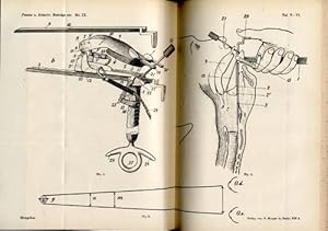 Seller image for ber Laryngoscopia direta (pp.166-173, 1 Abb., 2 Taf.). for sale by Antiq. F.-D. Shn - Medicusbooks.Com