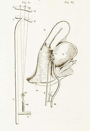 Seller image for Mmoire sur des moyens nouveaux de traitement des fistules vsico-vaginales, prsent  l'Acadmie des sciences. Extrait de la Gazette des hpitaux, septembre 1842. for sale by Jean-Pierre AUBERT