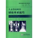 Bild des Verkufers fr Spine surgery surgical techniques difficult series of books: children's orthopedic spinal deformity surgery techniques(Chinese Edition) zum Verkauf von liu xing