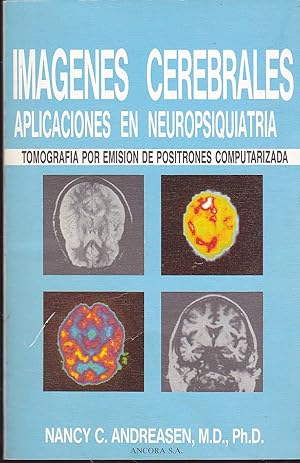 IMAGENES CEREBRALES -APLICACIONES EN NEUROPSIQUIATRIA Tomografía por emisión de positrones comput...