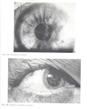 Infectious diseases of the conjunctiva & cornea : symposium of the New Orleans Academy of Ophthal...