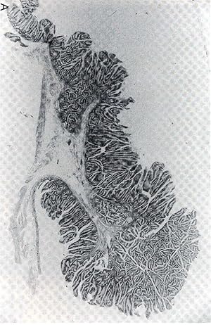 Seller image for Pathology of the gastrointestinal tract. [ndoscopy and Endoscopic Biopsy; Cytologic Techniques and Diagnosis; Immunohistology and Cytometry of the Gastrointestinal Tract; Structure and Function of the Gastrointestinal Immune System; Genetics and Cytogenetics of Gastrointestinal Disorders; Molecular Biology of Gastrointestinal Disorders; Cell Proliferation and Kinetics of the Gastrointestinal Epithelium; Disorders Common to the Gastrointestinal Tract; Embryology and Developmental Disorders; Chemical and Physical Disorders; Allergic Disorders; Motor and Mechanical Disorders; Vascular Disorders; Disorders of the Endocrine System; Immunodeficiency Disorders and Their Effects on the Gastrointestinal Tract; Lymphoproliferative Disorders] for sale by Joseph Valles - Books