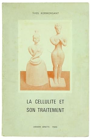 LA CELLULITE ET SON TRAITEMENT.: