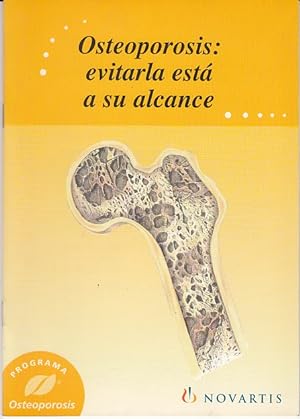 Bild des Verkufers fr OSTEOPOROSIS: EVITARLA EST A SU ALCANCE zum Verkauf von Librera Vobiscum
