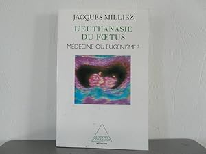 L'euthanasie du foetus