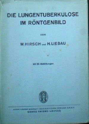 Bild des Verkufers fr Die Lungentuberkulose im Rntgenbild zum Verkauf von Versandantiquariat Karin Dykes