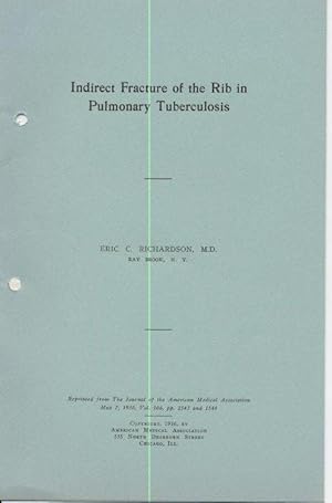 Indirect Fracture of the Rib in Pulmonary Tuberculosis