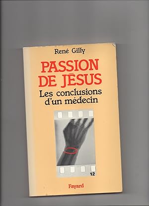 PASSION DE JESUS - Les Conclusions D'un Médecin