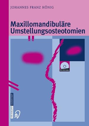 Immagine del venditore per Maxillomandibulre Umstellungsosteotomien venduto da AHA-BUCH GmbH