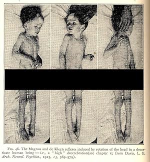 Bild des Verkufers fr Physiology of the Nervous System. (Outline of Physiology Series) [Oxford Medical Publications] [The Spinal Cord; Central inhibition; Medulla oblongata; Pons & Midbrain; Hypothalamus; Thalamus; Cerebral cortex; Extrapyramidal system; Basal Ganglia] zum Verkauf von Joseph Valles - Books