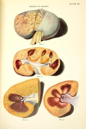 Original Papers of Richard Bright on Renal Disease. Edited by A. Arnold Osman.