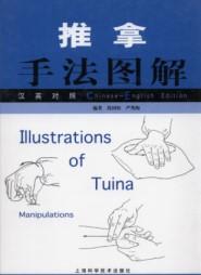 Bild des Verkufers fr Illustrations of Tuina Manipulations(Chinese Edition) zum Verkauf von liu xing