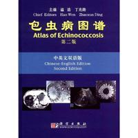 Immagine del venditore per Atlas of Echinococcosis (Second Edition)(Chinese Edition) venduto da liu xing