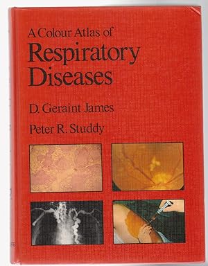 Seller image for A COLOUR ATLAS OF RESPIRATORY DISEASES for sale by BOOK NOW