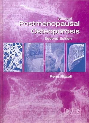 Bild des Verkufers fr Atlas of Postmenopausal Osteoporosis: Second Edition zum Verkauf von Antikvariat Valentinska