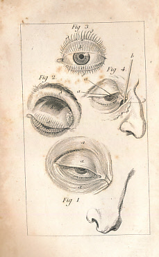 Image du vendeur pour Trait des Maladies des Yeux et des Oreilles, Considrs sous Le Rapport des Quatre Parties ou Quatre Ages de La Vie de L'Homme; Avec Les Remdes Curatifs, & Les Moyens Propres  Les Prserver des Accidens. 2 volume set mis en vente par Barter Books Ltd