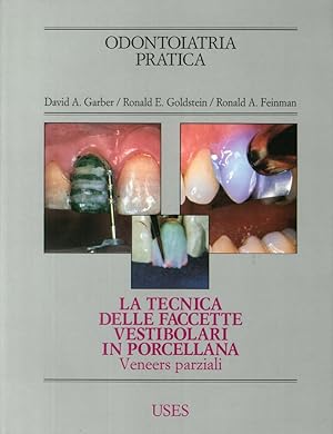 Bild des Verkufers fr La Tecnica delle Faccette Vestibolari in Porcellana zum Verkauf von Libro Co. Italia Srl