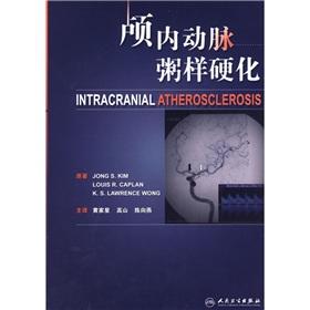 Immagine del venditore per Intracranial atherosclerosis(Chinese Edition) venduto da liu xing