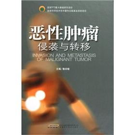 Immagine del venditore per Malignant tumor invasion and metastasis (hardcover)(Chinese Edition) venduto da liu xing