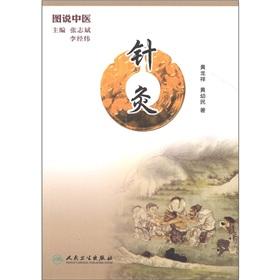 Imagen del vendedor de Diagram TCM: Acupuncture(Chinese Edition) a la venta por liu xing