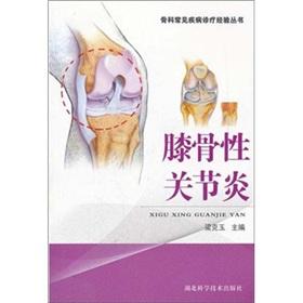 Image du vendeur pour Knee Osteoarthritis(Chinese Edition) mis en vente par liu xing