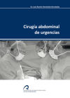 Cirugía abdominal de urgencias