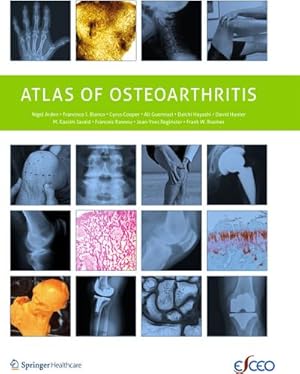 Bild des Verkufers fr Atlas of Osteoarthritis zum Verkauf von AHA-BUCH GmbH