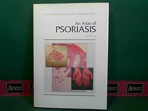 Bild des Verkufers fr An Atlas of Psoriasis. (= Encyclopedia of Visual Medicine). zum Verkauf von Antiquariat Deinbacher