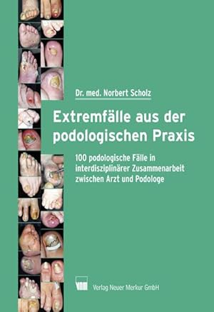 Seller image for Extremflle aus der podologischen Praxis for sale by Rheinberg-Buch Andreas Meier eK