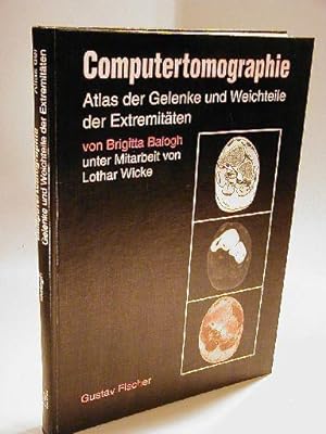 Bild des Verkufers fr Computertomographie. Atlas der Gelenke und Weichteile der Extremitten. zum Verkauf von Adalbert Gregor Schmidt