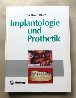 Imagen del vendedor de Implantologie und Prothetik. Mit 469 berwiegend farbigen Abbildungen. a la venta por Antiquariat Maralt
