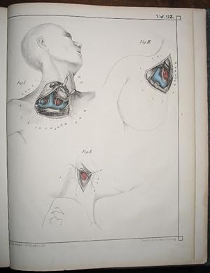 Lehre von den Operationen am Thorax des menschlichen Körpers. In Abbildungen mit erläuterndemText...
