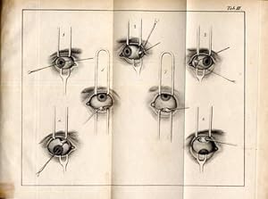 Ueber das Schielen und die Heilung desselben durch die Operation.