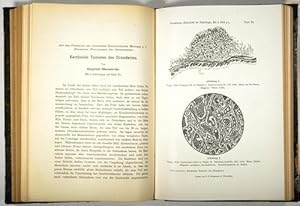 Krazinoide Tumoren des Dünndarms (pp.426-432, 1 Tafel).