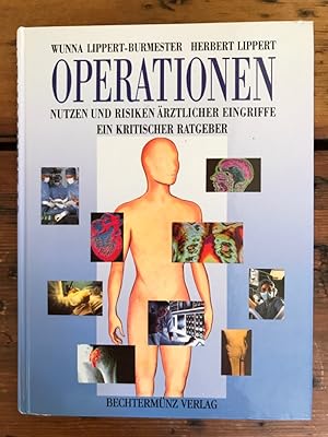 Image du vendeur pour Operationen - Nutzen und Risiken rtzlicher Eingriffe; ein kritischer Ratgeber mis en vente par Antiquariat Liber Antiqua